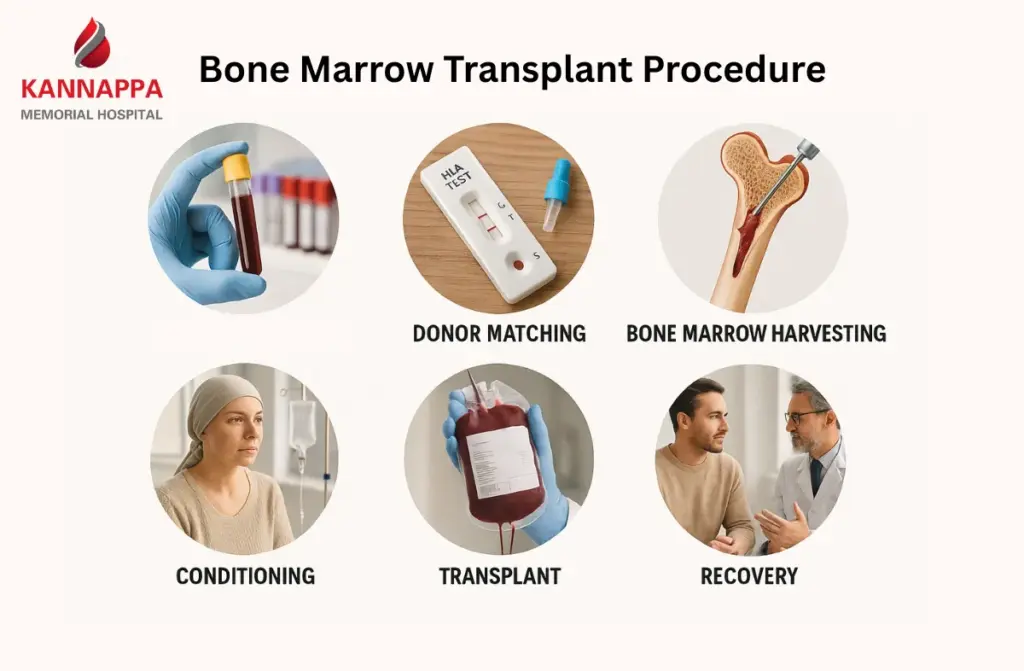Best Bone Marrow Transplant Hospital in Chennai 