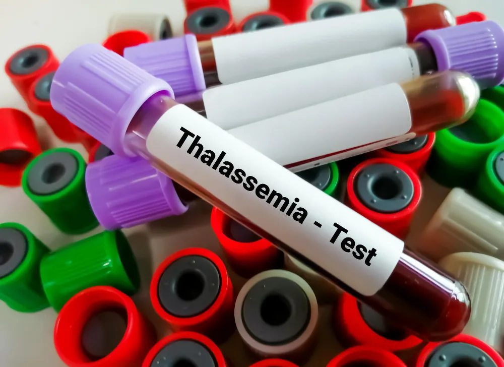 Thalassemia