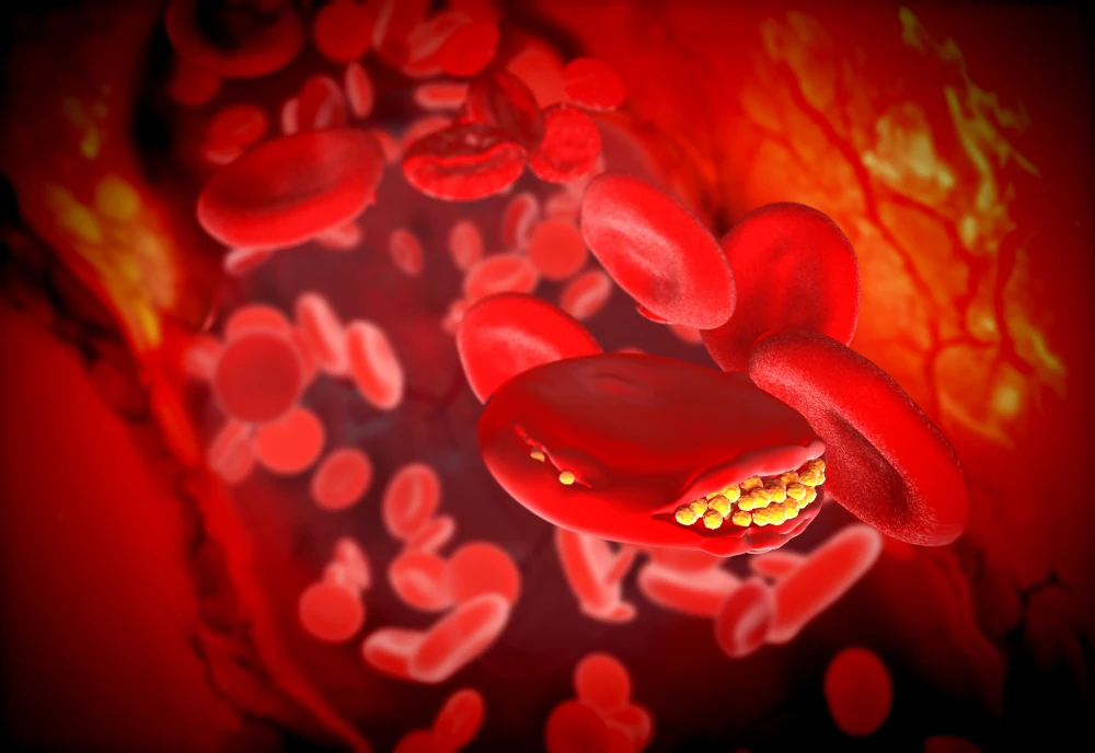 Leukemia