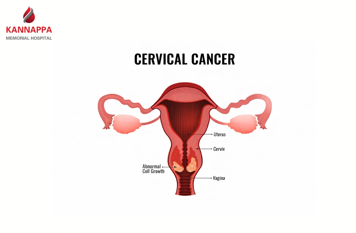 Cervical cancer