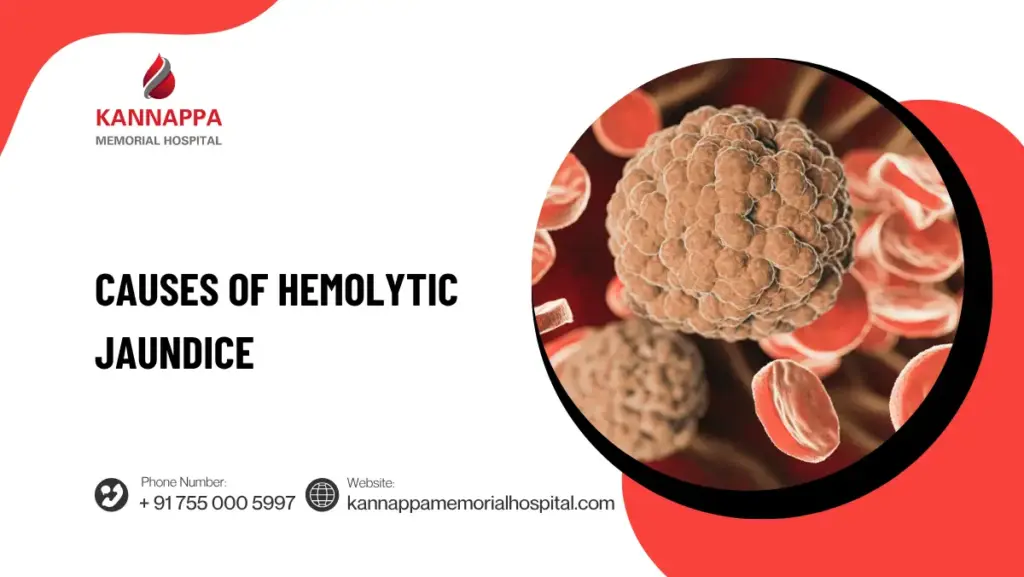 Causes of Hemolytic Jaundice