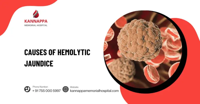 Causes of Hemolytic Jaundice