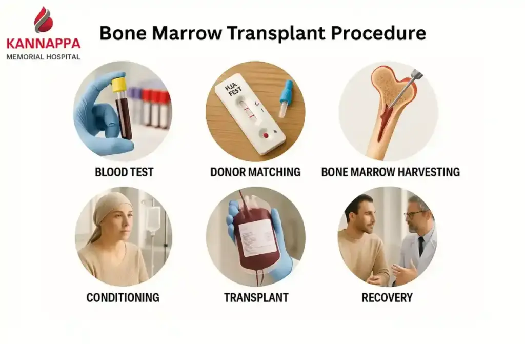 Best Bone Marrow Transplant Hospital in Chennai