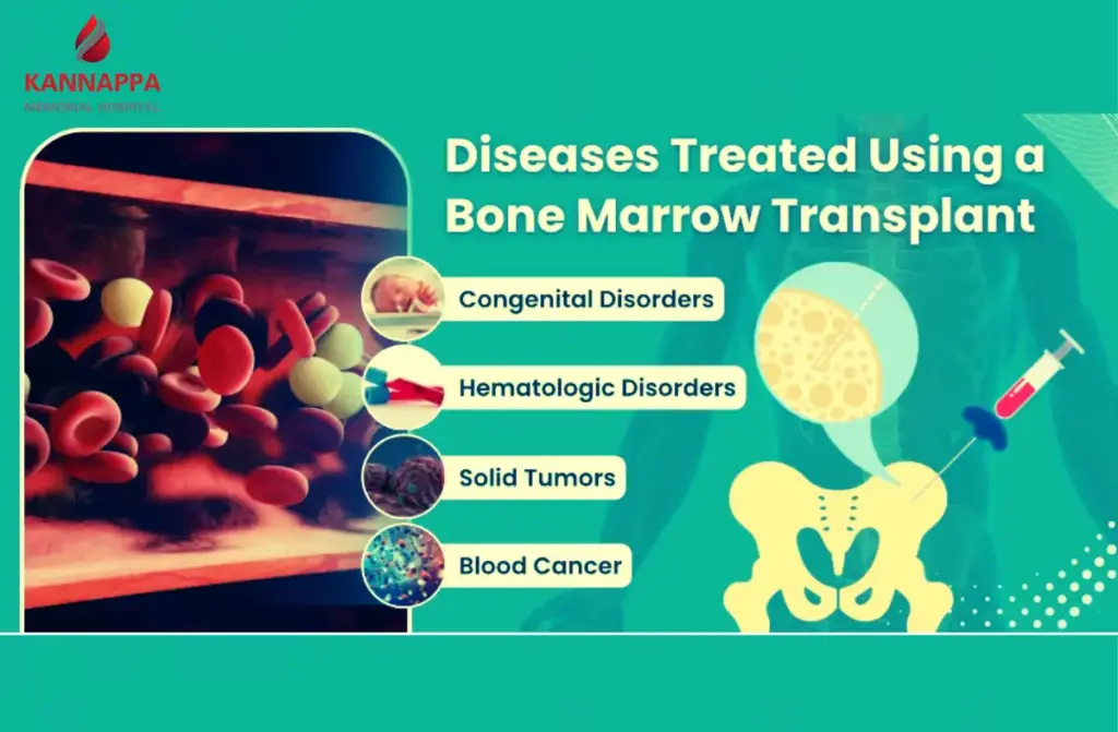 Bone Marrow Transplant Success Rate in India