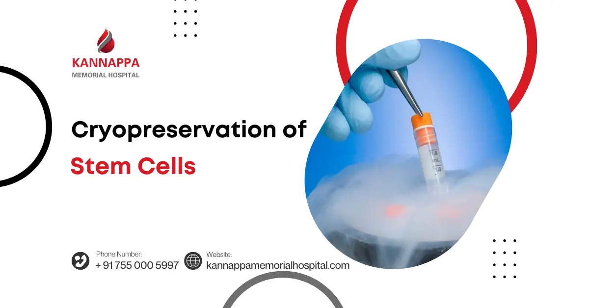Cryopreservation of Stem Cells
