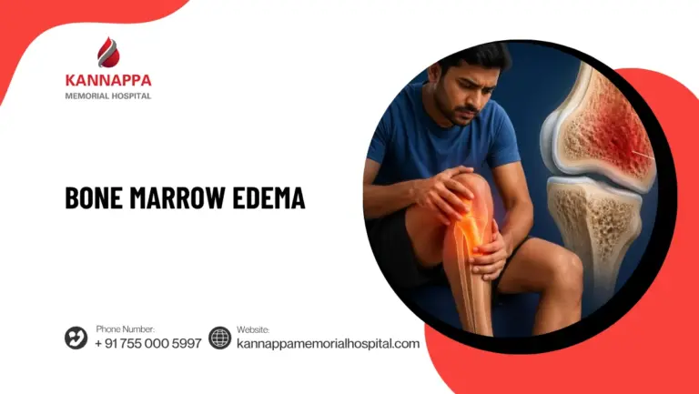 Bone Marrow Edema