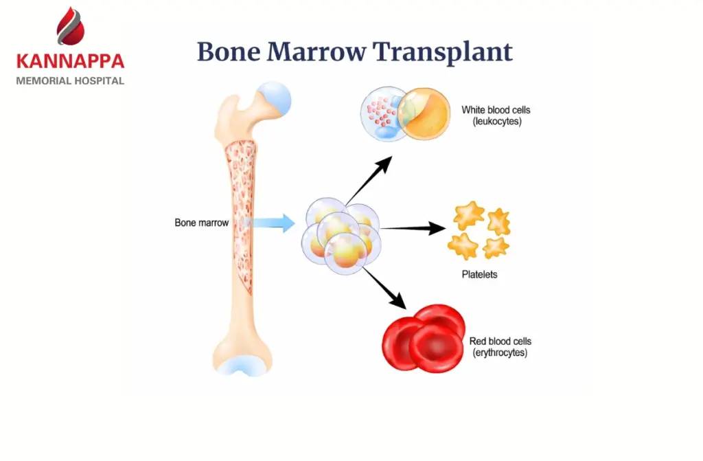 Bone Marrow Transplant side effects 