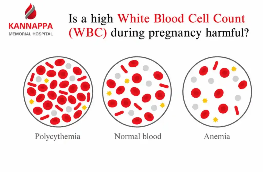 High White Blood Cell Count 