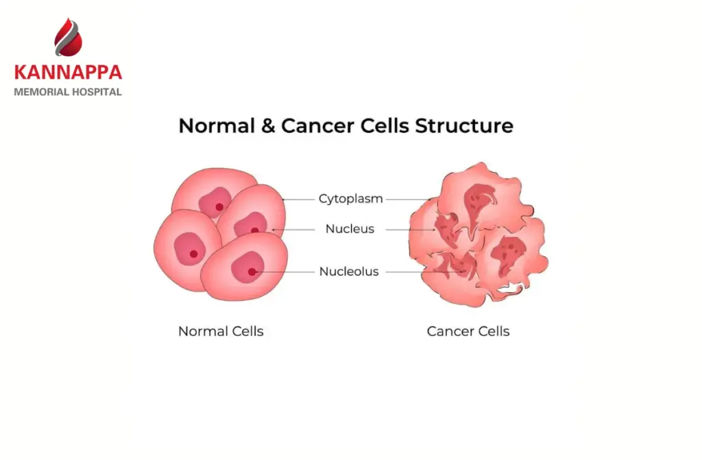 Best Oncologist in Chennai