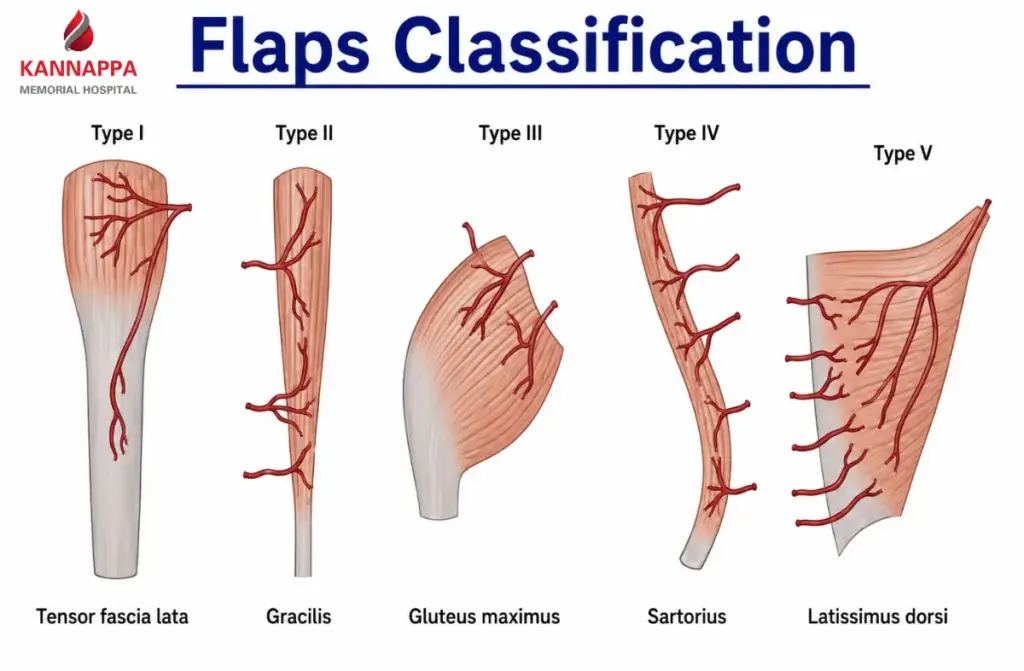 Free Flap Surgery