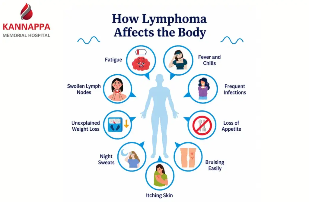 Lymphoma  Cancer Symptoms 
